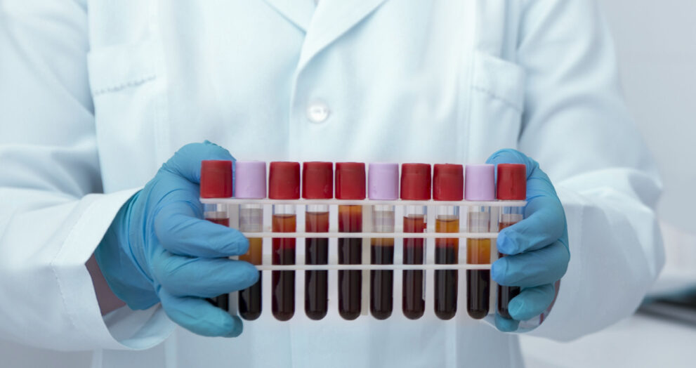 ‘Sarah’ 37 Case Study