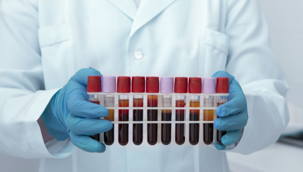 ‘Sarah’ 37 Case Study