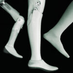 Pregnancy and Gynaecology Injury Claims