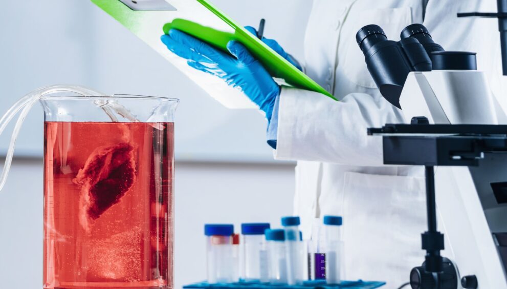 ‘Chris’ 59 Case Study