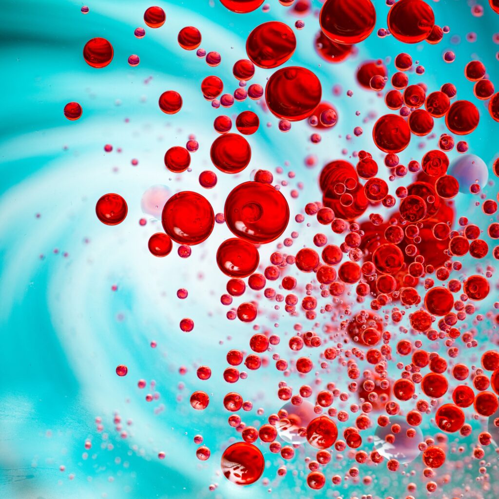 Sepsis Negligence Claims