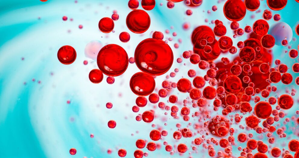 Sepsis Negligence Claims