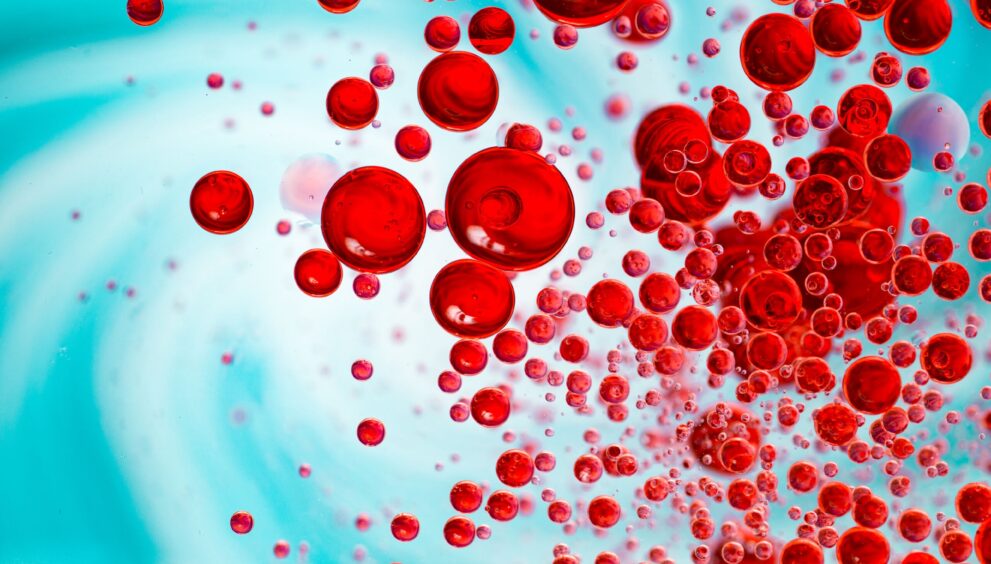 Sepsis Negligence Claims