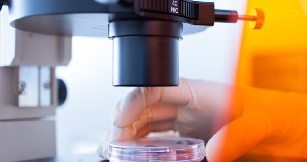 ‘Max’ a man in his 30s Case Study