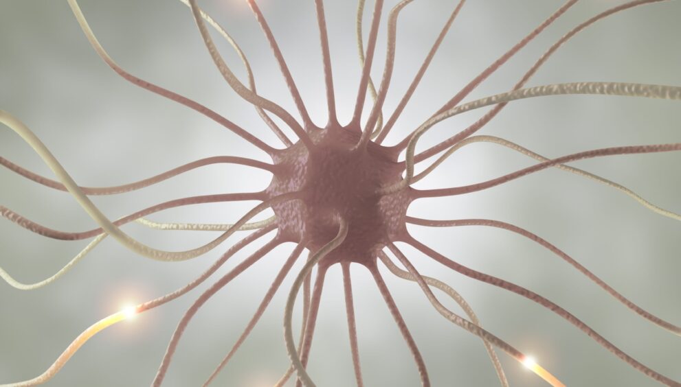 ‘Pamela’ 43 Case Study