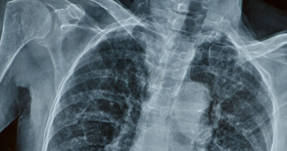 ‘Philippa’ 58 a man in his 50s