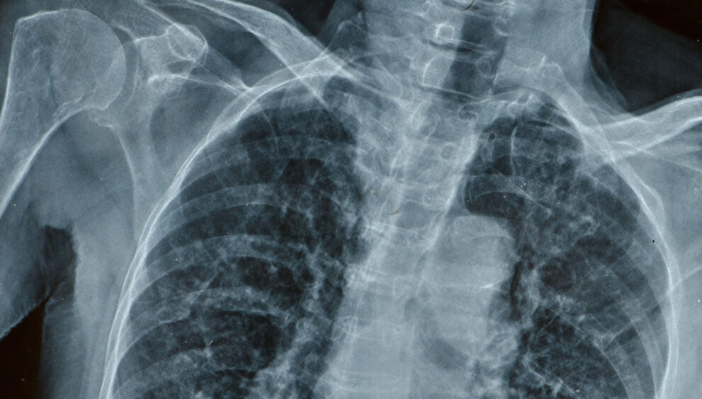 ‘Philippa’ 58 a man in his 50s