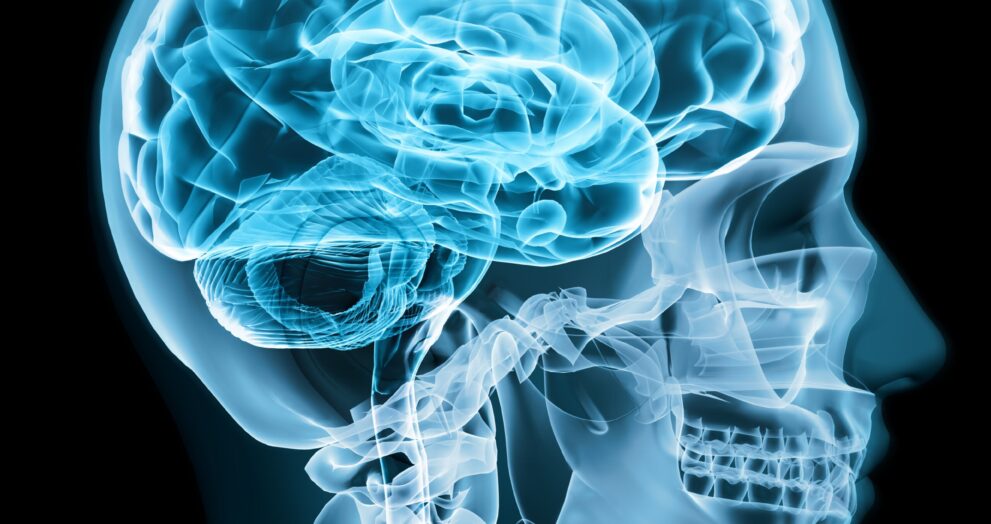 “Zakir” now 8 Case Study