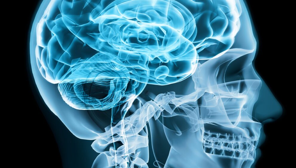 “Zakir” now 8 Case Study